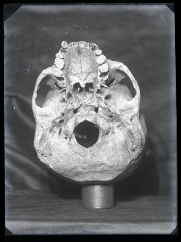 Primera imagen del registro Vista inferior de cráneo humano